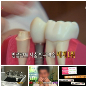 임플란트 부작용 예방하려면 '병원 시스템' 체크부터 