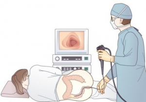 진행된 대장암 치료 방법은??