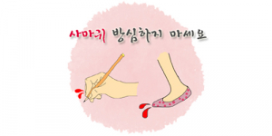 근본적인 사마귀치료 한의학으로 해결하세요 