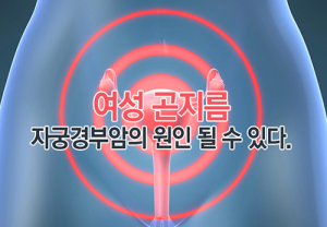 곤지름 난치성 피부질환 