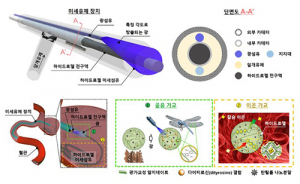 포스텍, 신개념 뇌동맥류 치료법 개발…세계 최초