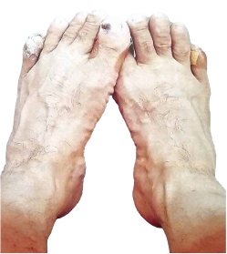 황재철의 부르터진 발 … 경북도의회 입성 영광의 3선 뱃지 달았다